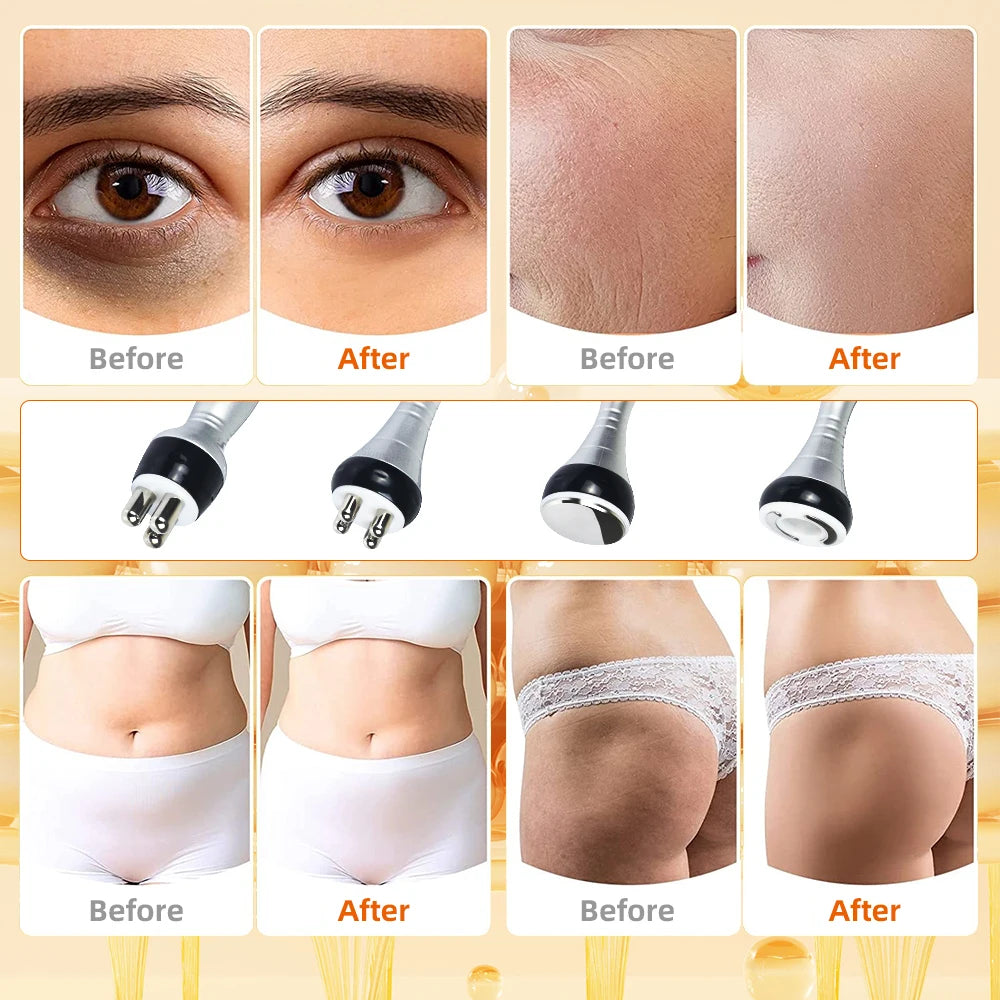 Cavitation Body Slimming Machine Beauty Device Facial Massager Skin Tighten Face Lifting Vacuum Suction